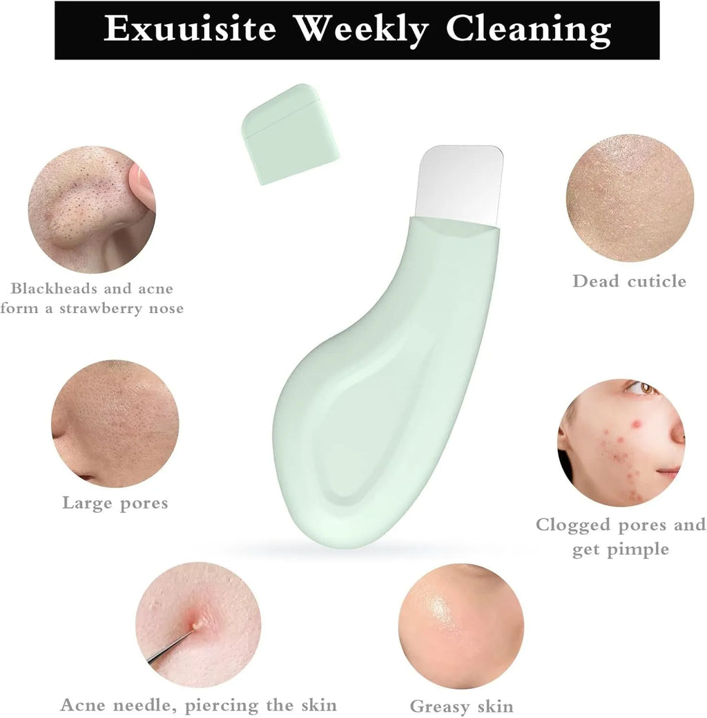 Stainless steel facial pore scraper tool with a non-slip handle for blackhead removal.