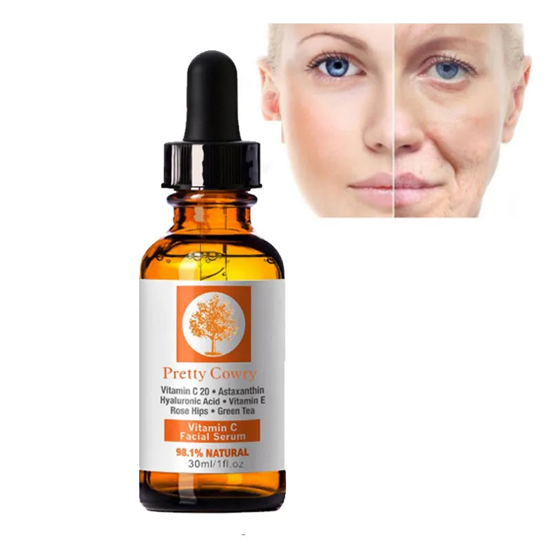 Vitamin C brightening serum in a 30ml bottle for skin whitening and freckle removal