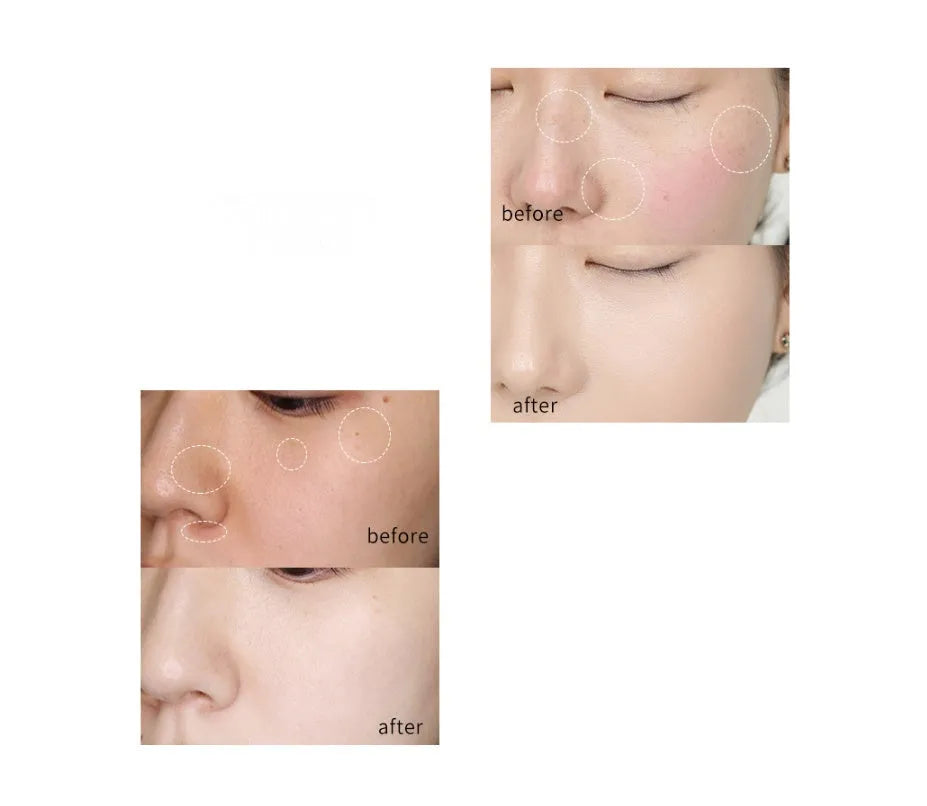 Whitening cream 20g tube for brightening skin and reducing dark spots