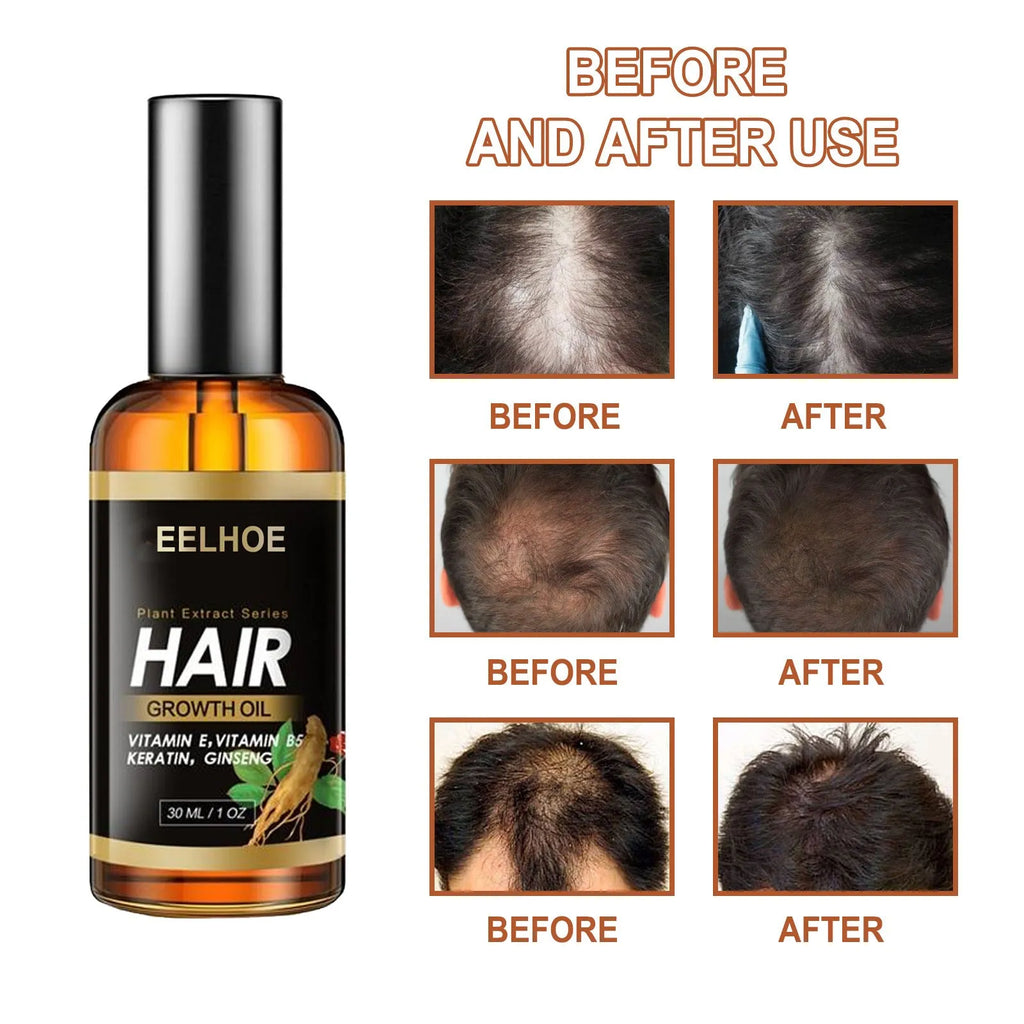EELHOE herb hair care essential oil bottle, anti-hair loss and nourishing treatment