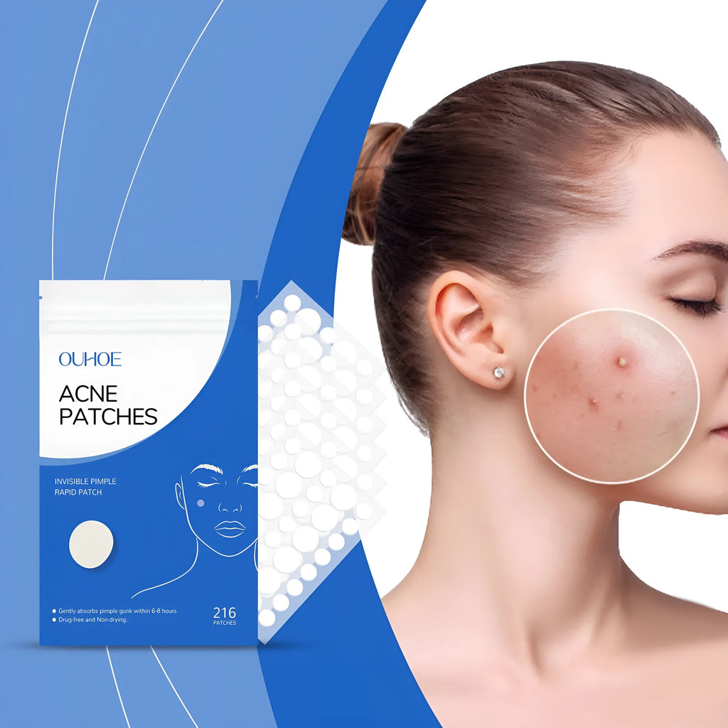 Pack of 216 acne patches with tea tree oil and Vitamin E for facial blemish treatment