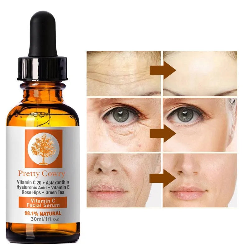 Vitamin C brightening serum in a 30ml bottle for skin whitening and freckle removal
