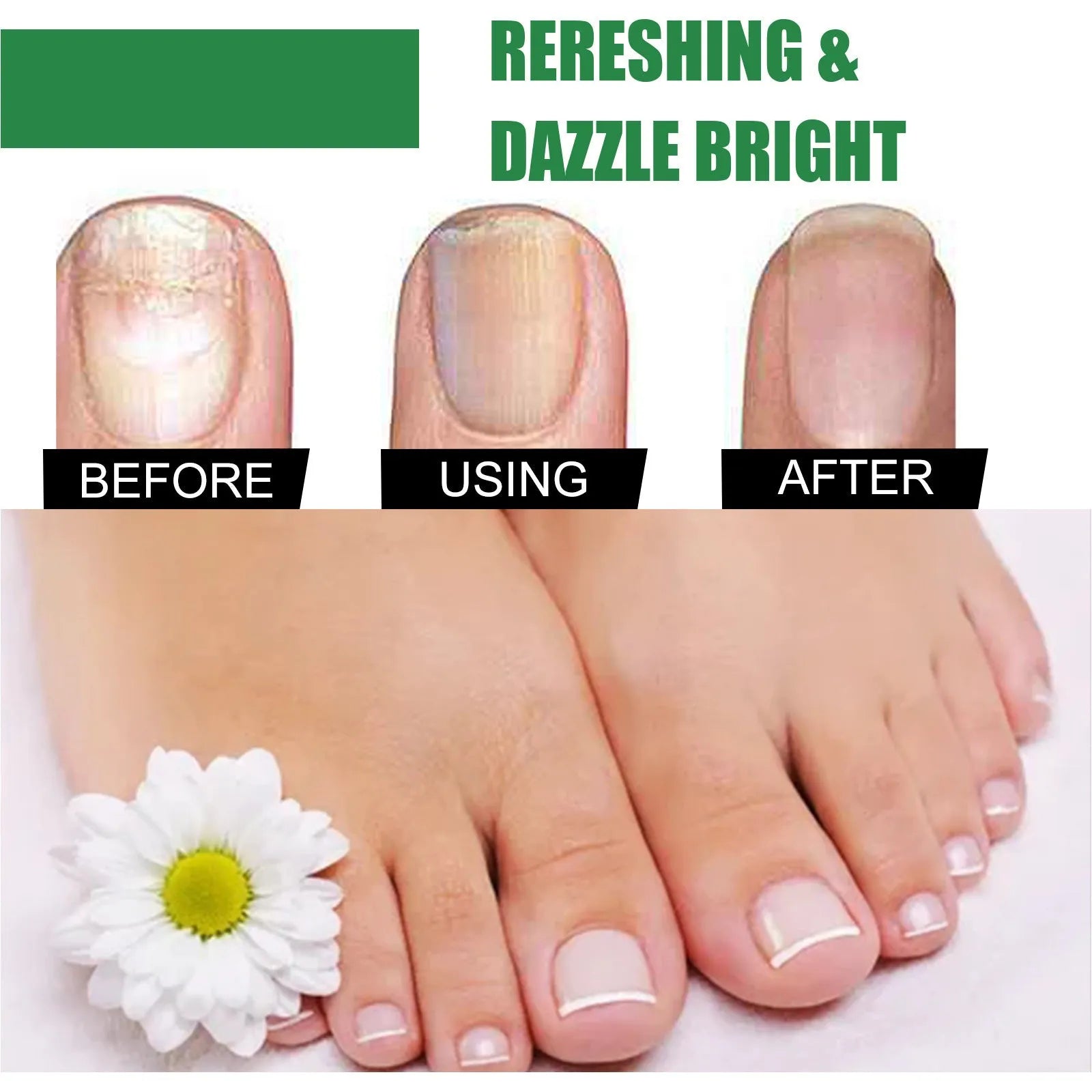 30ml tea tree oil foot and hand nail treatment liquid for thick soft nails