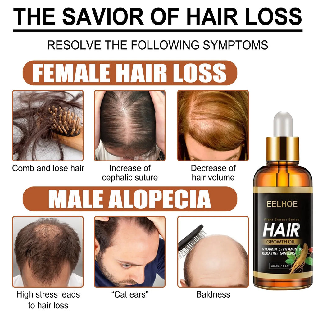 EELHOE herb hair care essential oil bottle, anti-hair loss and nourishing treatment