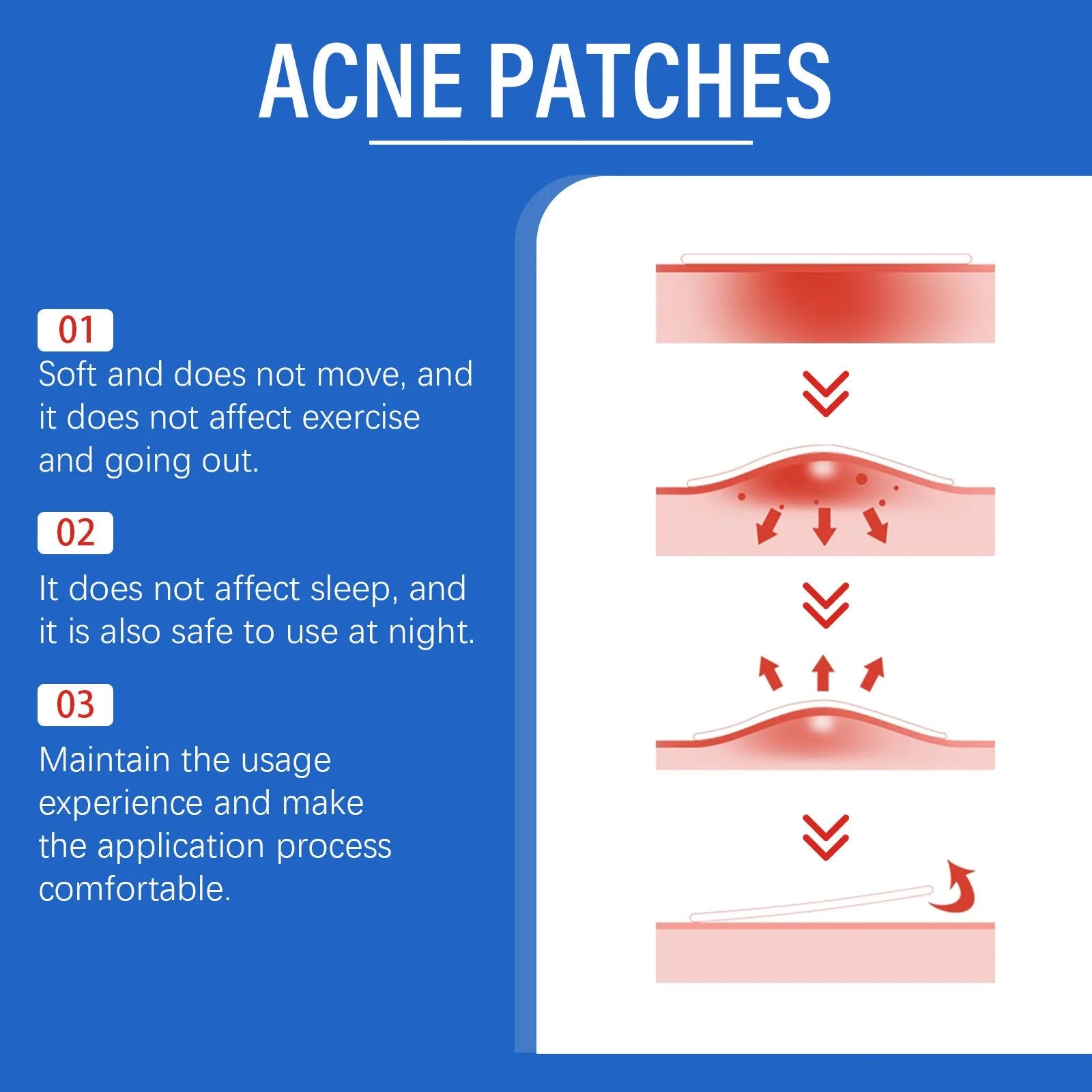 Pack of 216 acne patches with tea tree oil and Vitamin E for facial blemish treatment