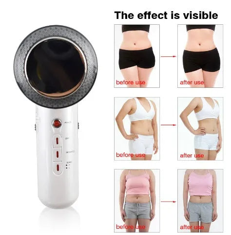 Handheld ultrasound EMS infrared body slimming device with electrode sheet and cable, 25.2x18x7.2cm