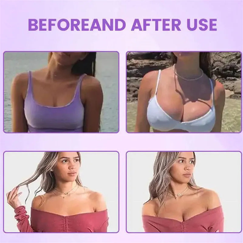 Skin-coloured silicone chest patches for temporary breast enhancement and cleavage shaping