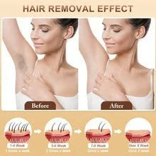 Home-use electric hair removal device with high-intensity pulsed light for full-body hair removal and photonic skin rejuvenation, EU or US plug option