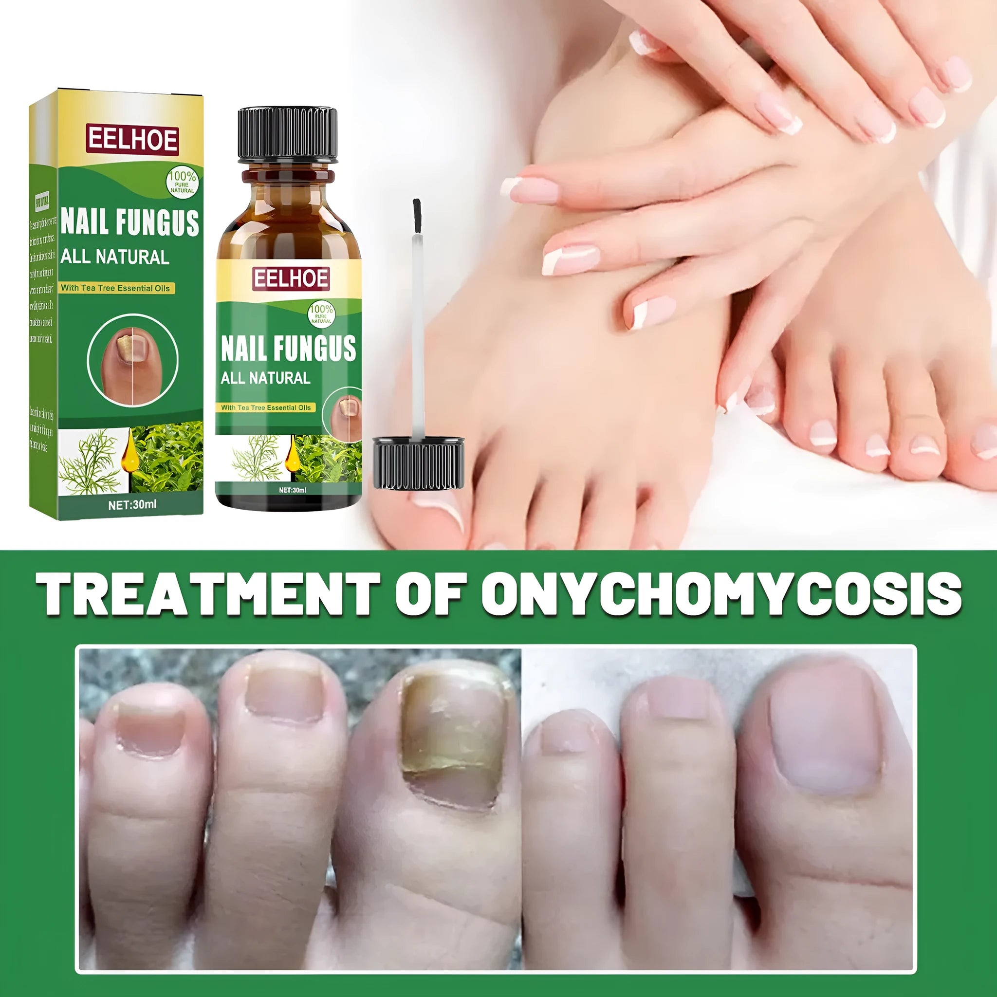 30ml tea tree oil foot and hand nail treatment liquid for thick soft nails