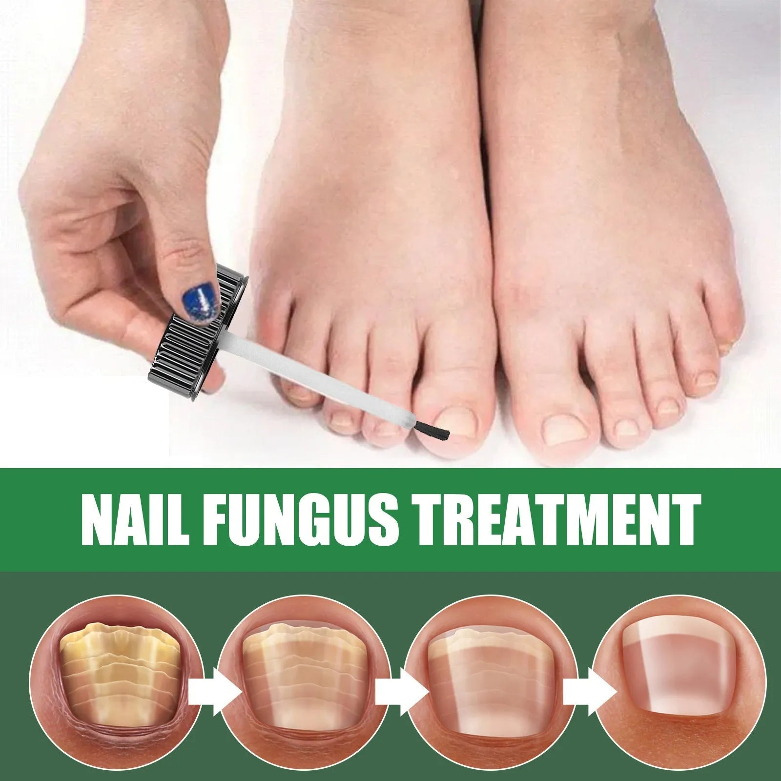30ml tea tree oil foot and hand nail treatment liquid for thick soft nails