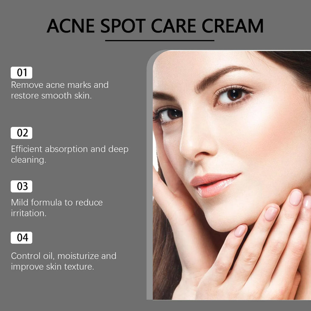 15g jar of hydrating acne cream with tea tree oil and aloe vera for facial blemish treatment