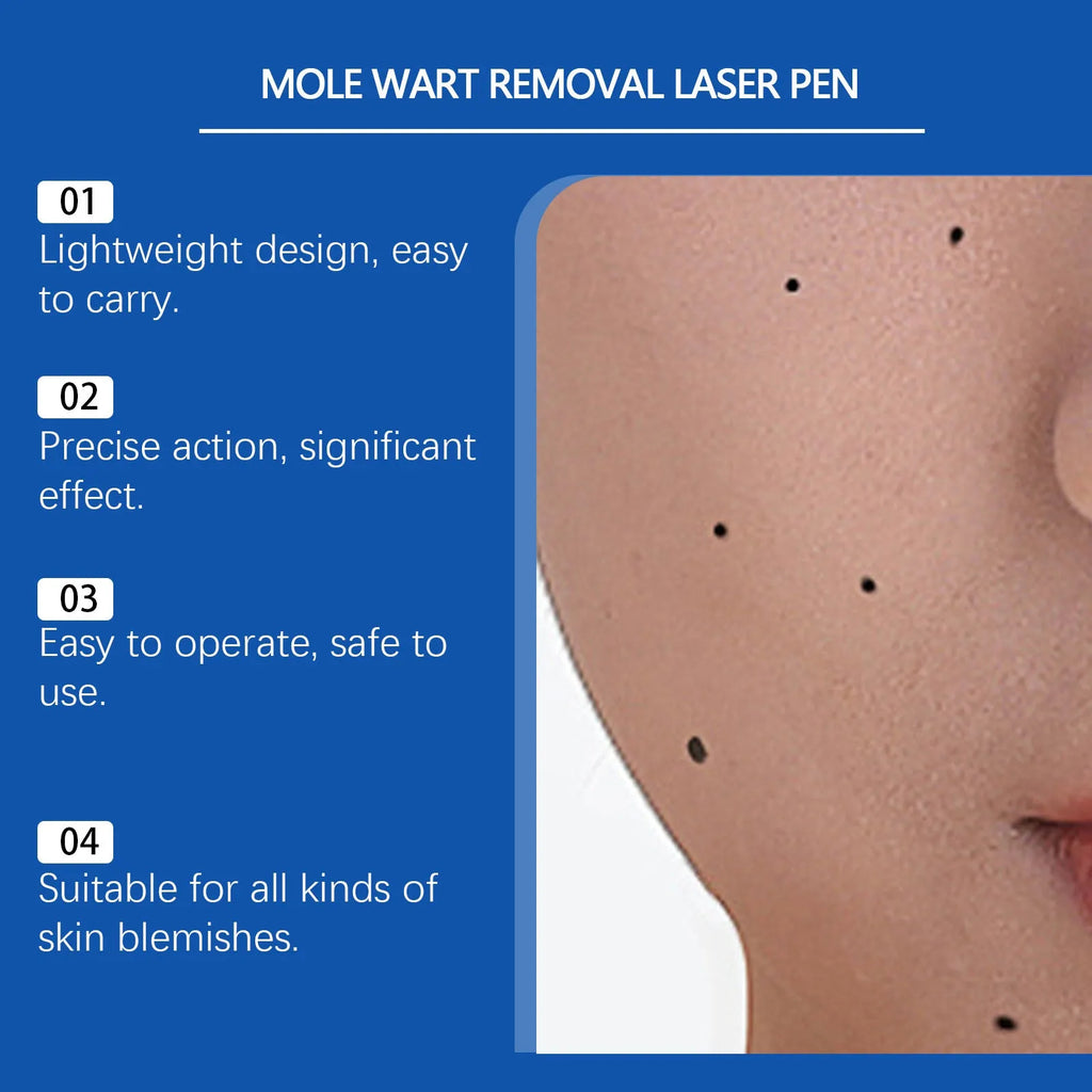 Mole wart removal laser pen with adjustable power settings and ABS plastic construction