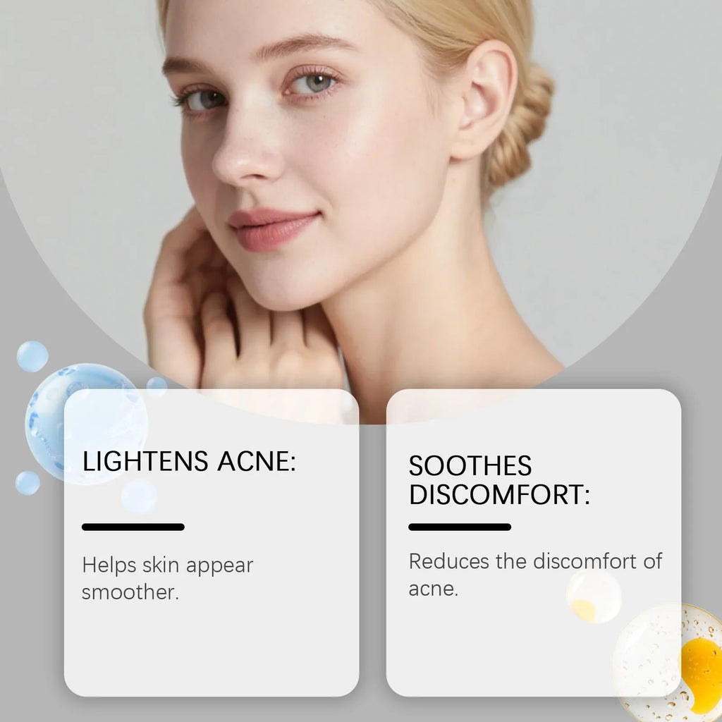 Pack of 80 hydrocolloid facial acne patches for spot treatment