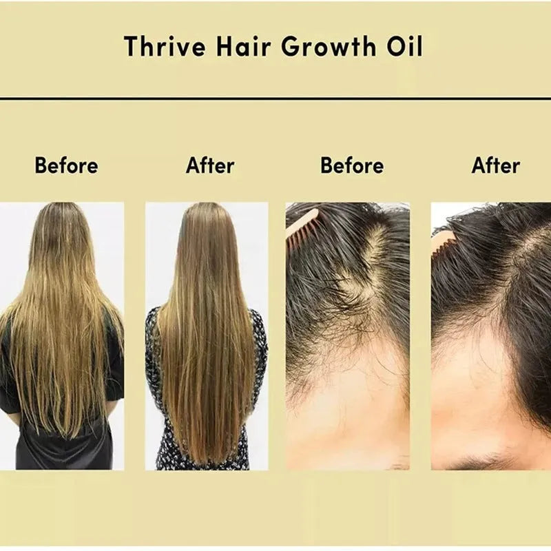 Yellow rosemary hair care essential oil bottle with 60ml net content for tough hair and split end treatment